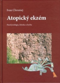 Obrázok - Atopický ekzém